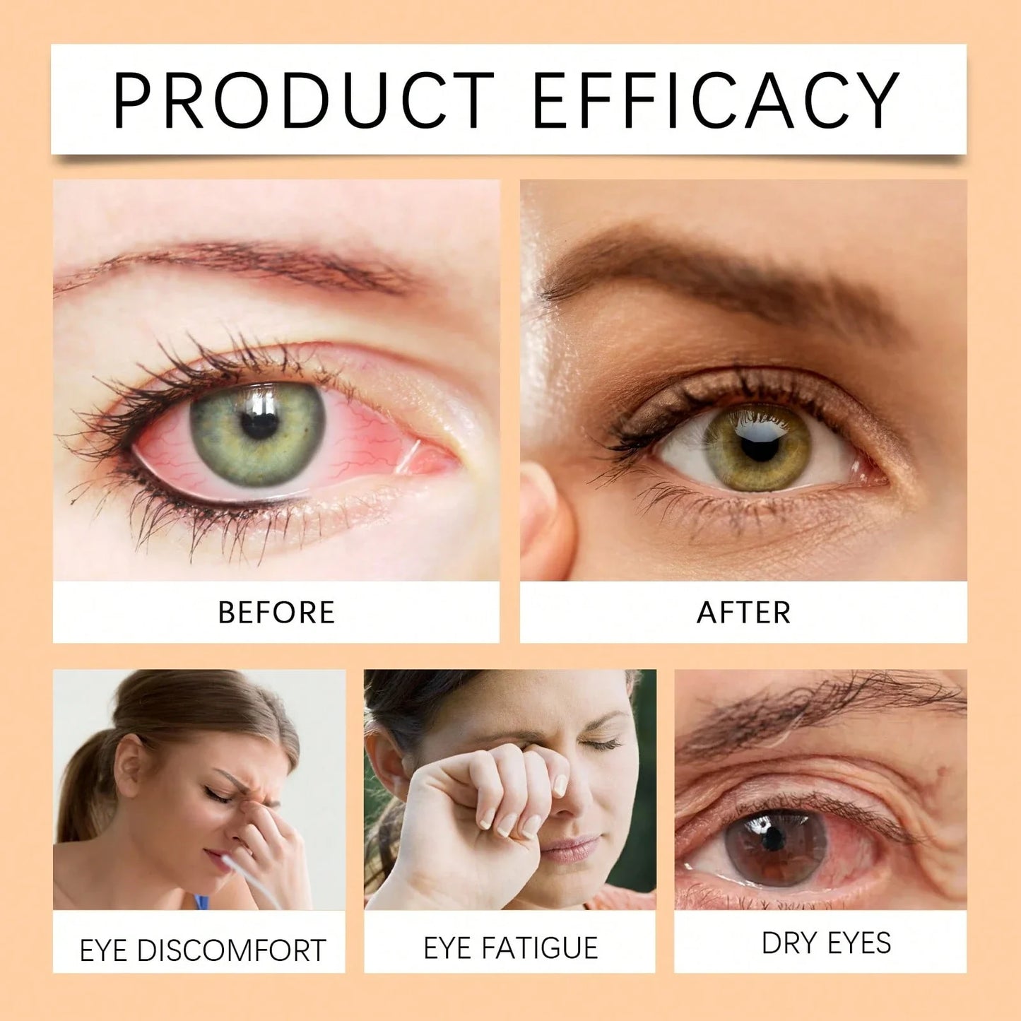 Ximonth Bee Honey Eye Drops